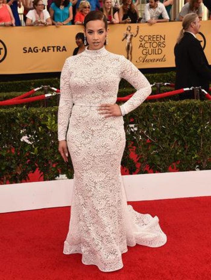 SAG Awards 2015: El patinazo de Naomi Watts por culpa del vestido de Emma Stone (VÍDEO)