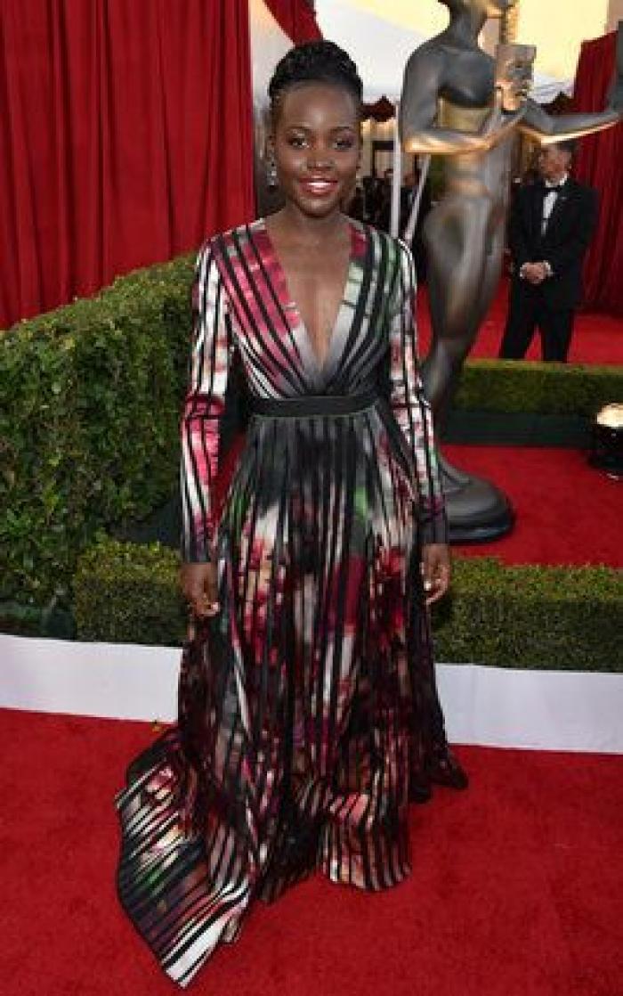 SAG Awards 2015: El patinazo de Naomi Watts por culpa del vestido de Emma Stone (VÍDEO)