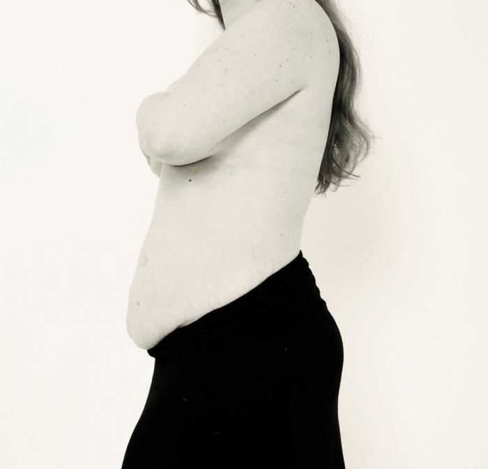 Tania Llasera arrasa con este alegato a favor de las estrías y cicatrices