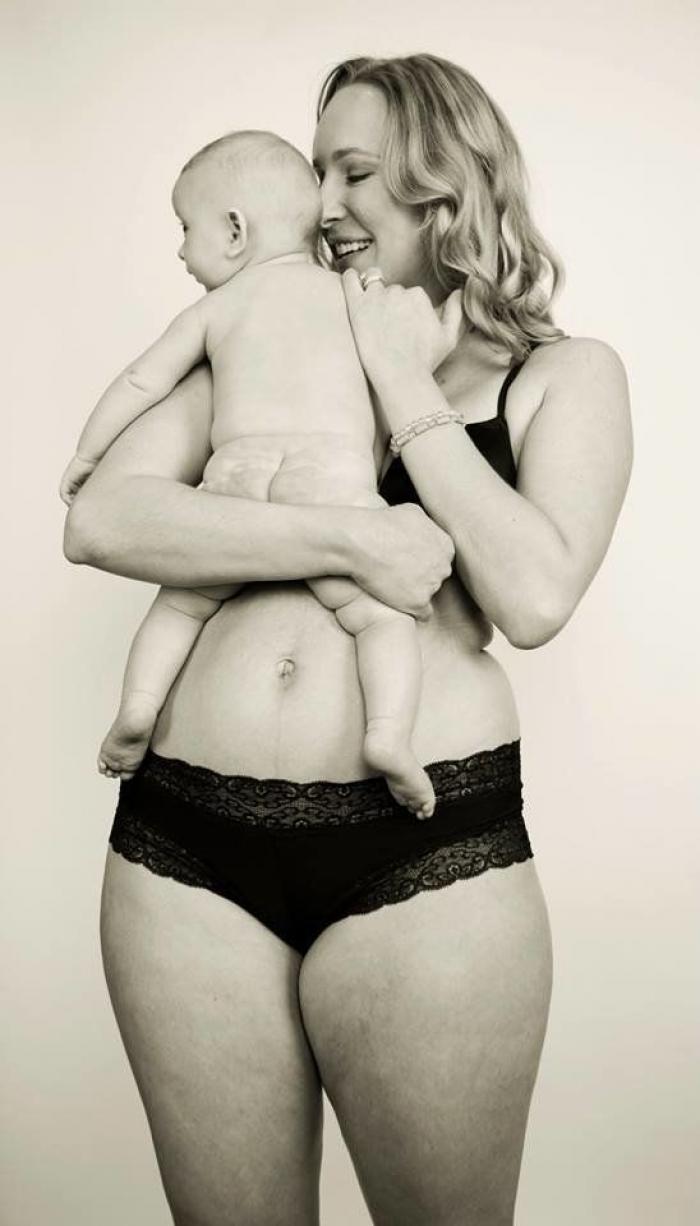 Tania Llasera arrasa con este alegato a favor de las estrías y cicatrices