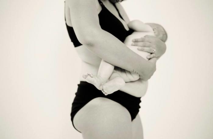 Tania Llasera arrasa con este alegato a favor de las estrías y cicatrices