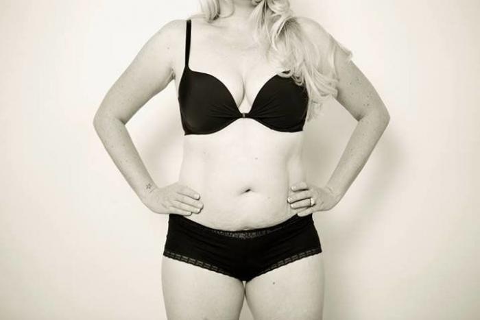 Tania Llasera arrasa con este alegato a favor de las estrías y cicatrices