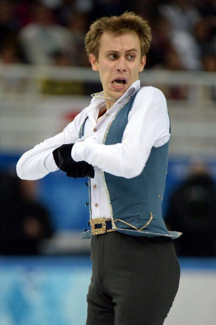 La otra cara del patinaje artístico (FOTOS)