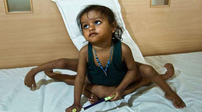 La realidad de la fibromialgia: una enfermedad que va más allá del dolor