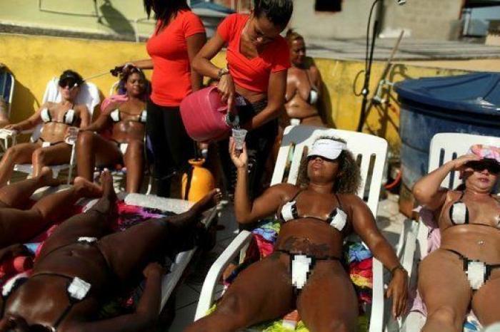 La 'marquinha', la peligrosa moda brasileña de tomar el sol con cinta aislante