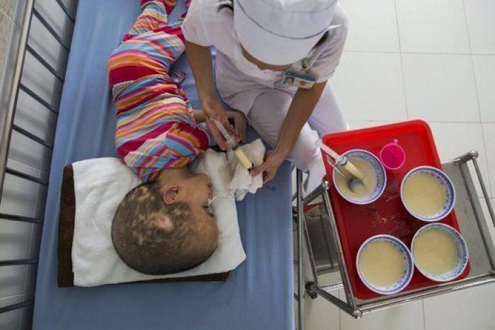 40 años de agente naranja en Vietnam