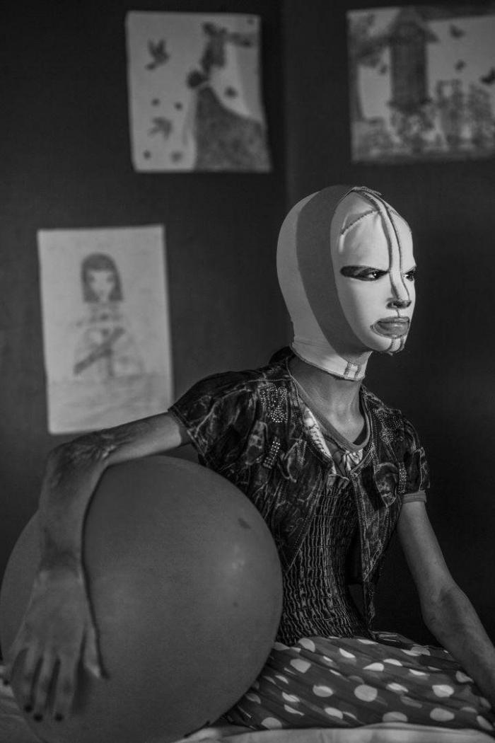 El joven en llamas, la historia detrás de la foto del año del World Press Photo