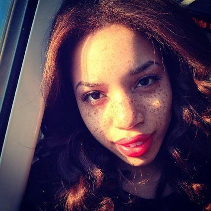 31 fotos increíbles que demuestran que las pecas molan