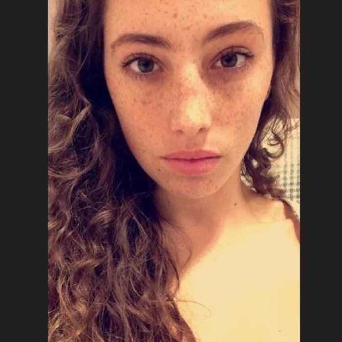 31 fotos increíbles que demuestran que las pecas molan