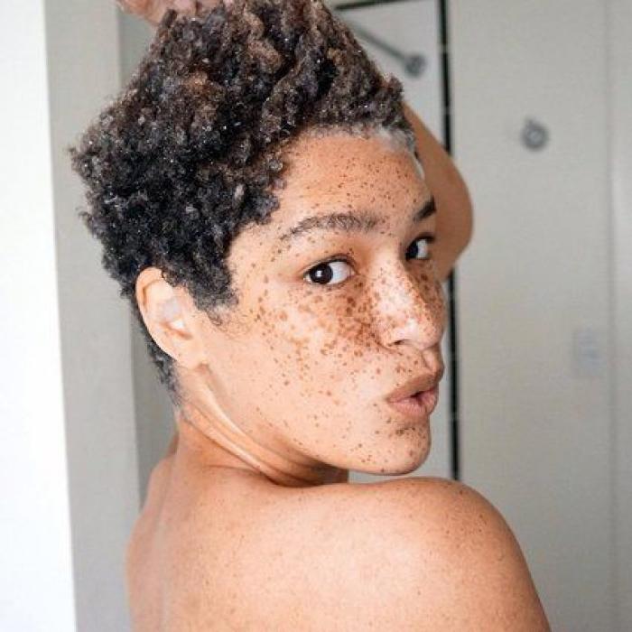 31 fotos increíbles que demuestran que las pecas molan