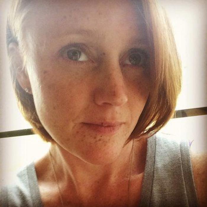 31 fotos increíbles que demuestran que las pecas molan