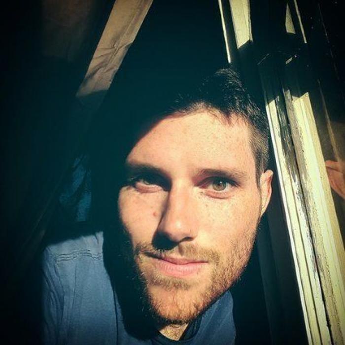 31 fotos increíbles que demuestran que las pecas molan