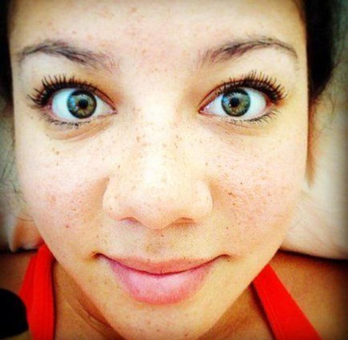 31 fotos increíbles que demuestran que las pecas molan
