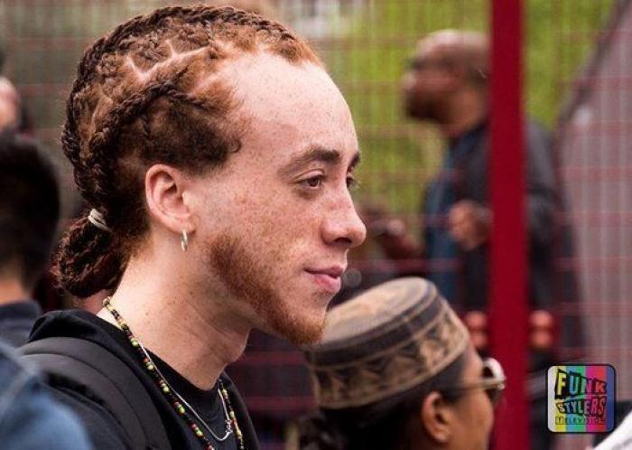 31 fotos increíbles que demuestran que las pecas molan