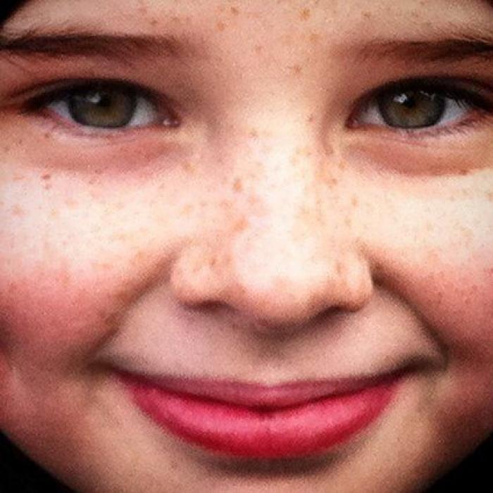31 fotos increíbles que demuestran que las pecas molan