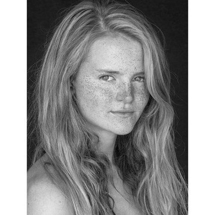 31 fotos increíbles que demuestran que las pecas molan