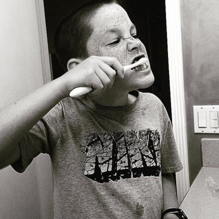 31 fotos increíbles que demuestran que las pecas molan