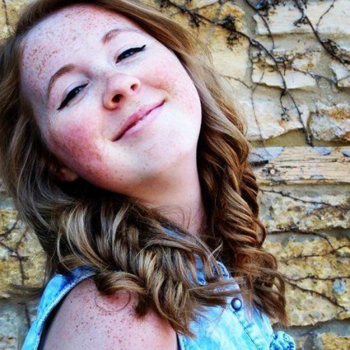 31 fotos increíbles que demuestran que las pecas molan