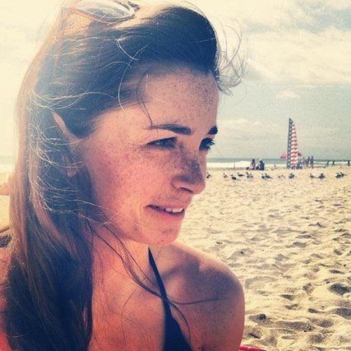 31 fotos increíbles que demuestran que las pecas molan