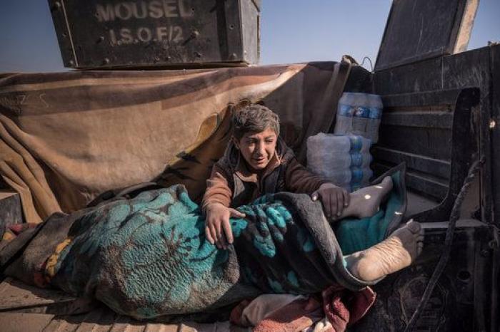 Todas las fotos premiadas en el World Press Photo 2017