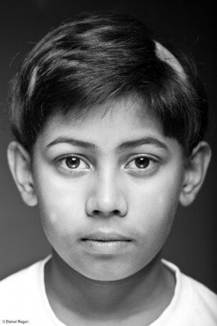 Una joven con alopecia celebra su calvicie con una sesión de fotos