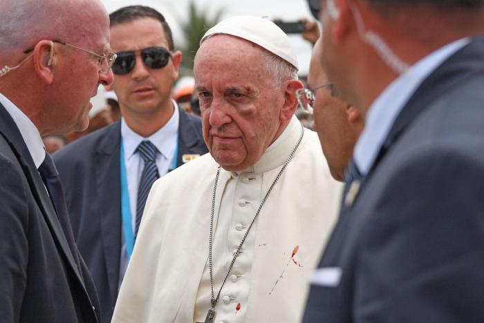 El papa Francisco se golpea con el papamóvil en la cara
