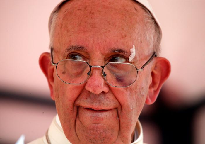 El papa Francisco se golpea con el papamóvil en la cara