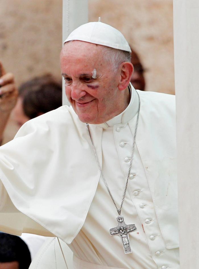 El papa Francisco se golpea con el papamóvil en la cara