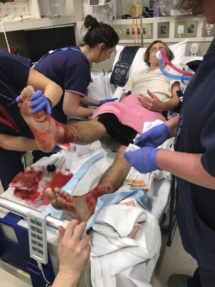 Un joven sale del mar con las piernas devoradas por unas pequeñas criaturas marinas en Australia