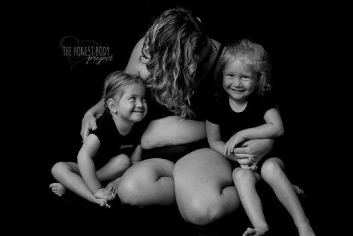 Las alegrías y tristezas de criar hijos con necesidades especiales