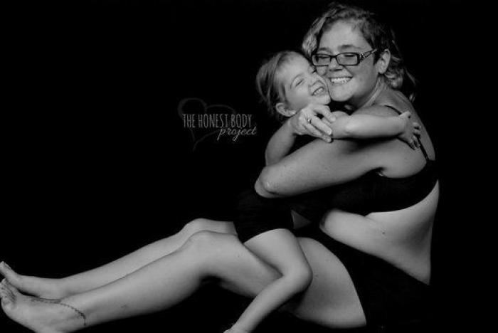 Las alegrías y tristezas de criar hijos con necesidades especiales