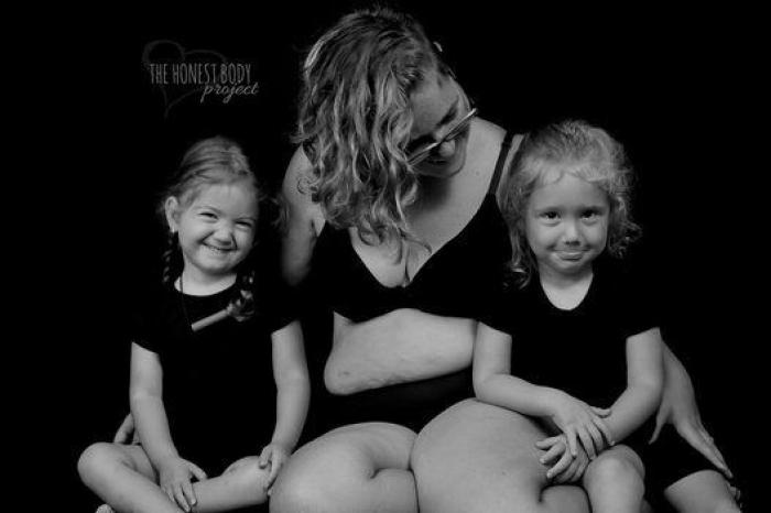 Las alegrías y tristezas de criar hijos con necesidades especiales