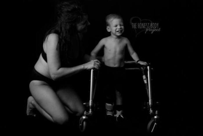 Las alegrías y tristezas de criar hijos con necesidades especiales