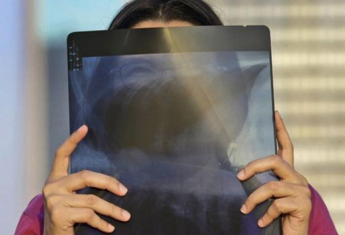 Las mejores fotos del eclipse total de Sol que se vio en Asia