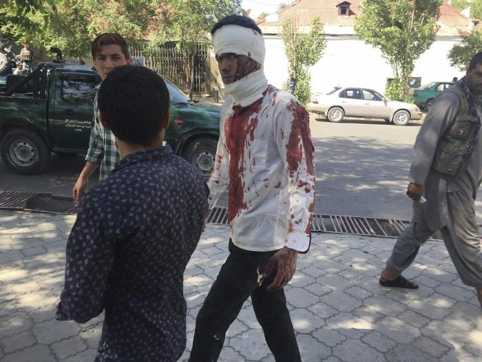 Al menos 80 muertos y más de 300 heridos por un atentado en Kabul