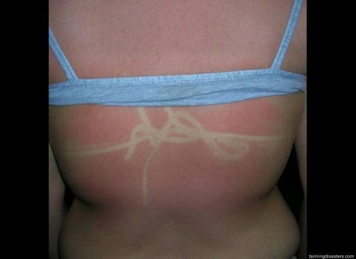 ¿Cuánto sol es bueno para la salud?