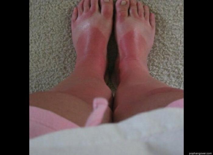 ¿Cuánto sol es bueno para la salud?