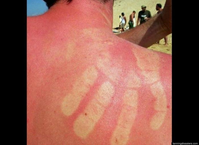 ¿Cuánto sol es bueno para la salud?