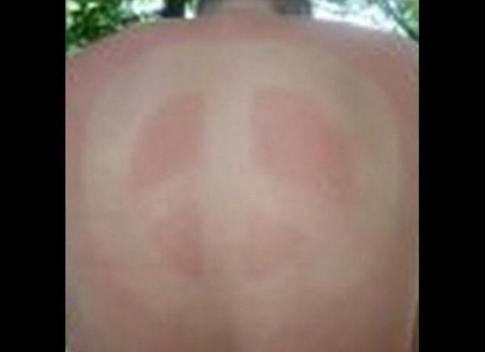 ¿Cuánto sol es bueno para la salud?