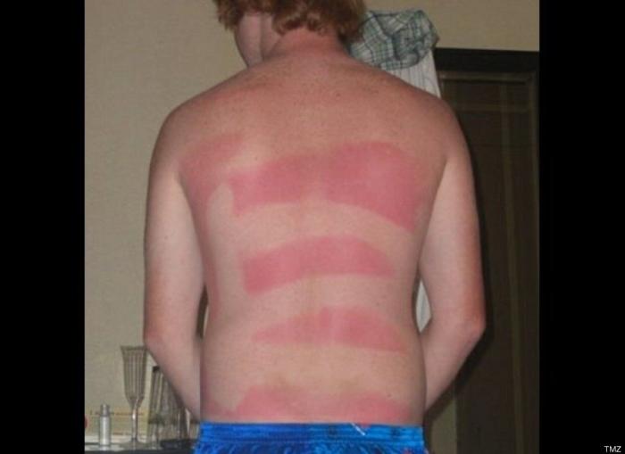 ¿Cuánto sol es bueno para la salud?