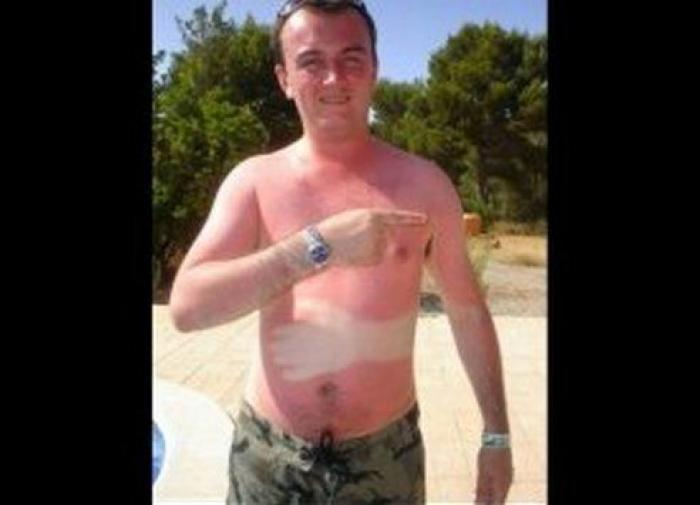 ¿Cuánto sol es bueno para la salud?