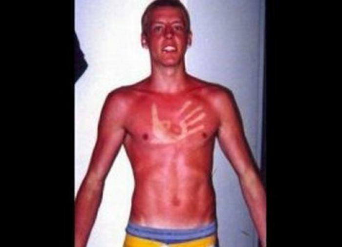 ¿Cuánto sol es bueno para la salud?