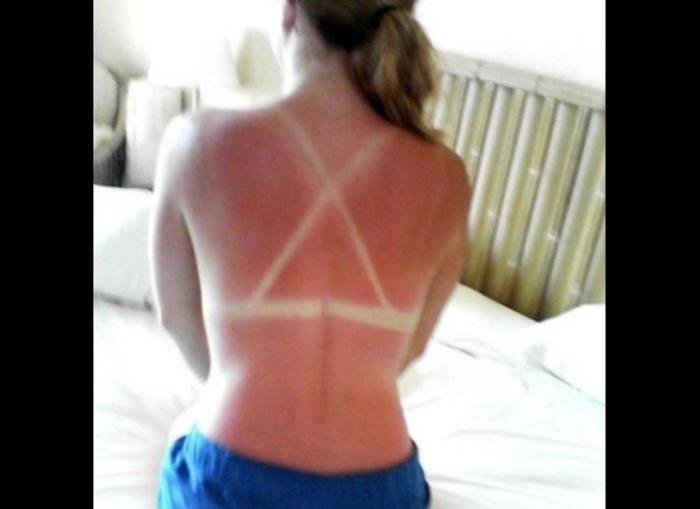 ¿Cuánto sol es bueno para la salud?