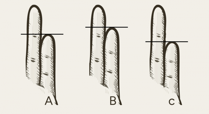 Acertijo visual de los dedos meñiques