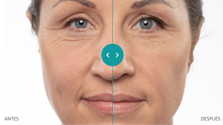 Remescar: crema antiarrugas con efecto inmediato y duradero (para hombres y mujeres)