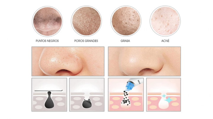 Pasos para utilizar el succionador de poros correctamente.