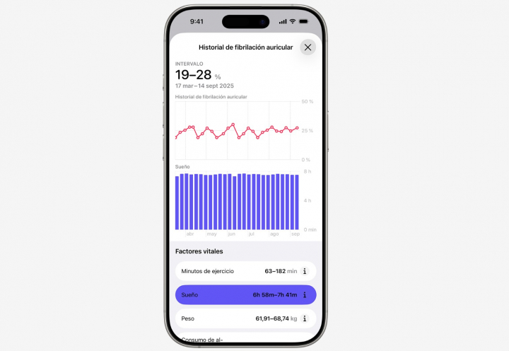 Historial de fibrilación auricular