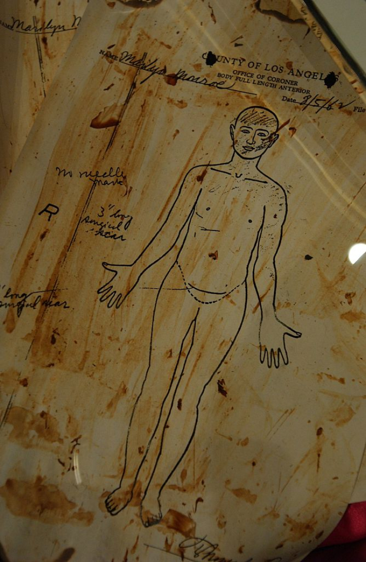 Una de las hojas del informe forense de la autopsia de Marilyn Monroe