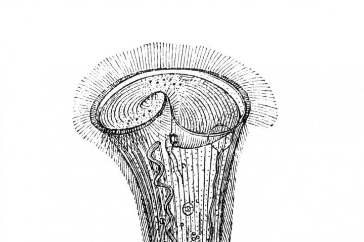 Ilustración de un Stentor roeselii