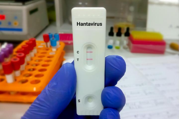 Una prueba de hantaviurs
